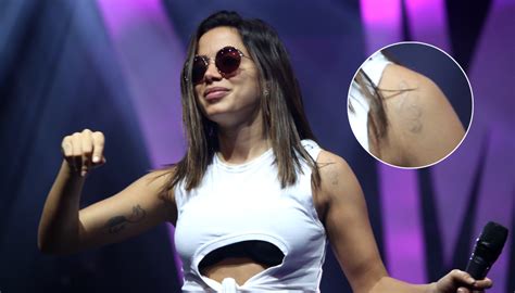 anitta tattoo|Anitta explica o motivo da nova tatuagem, que tem。